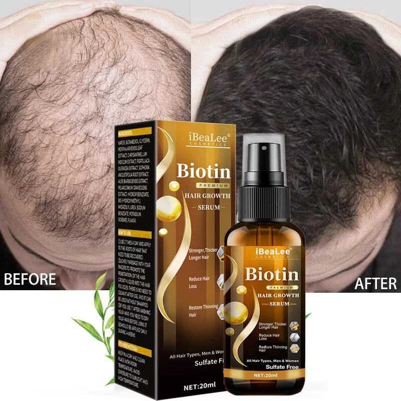 Hair care solution, strong hai – Roots Nutrition & Fitness Inglewood Photos Bewertung und Preis