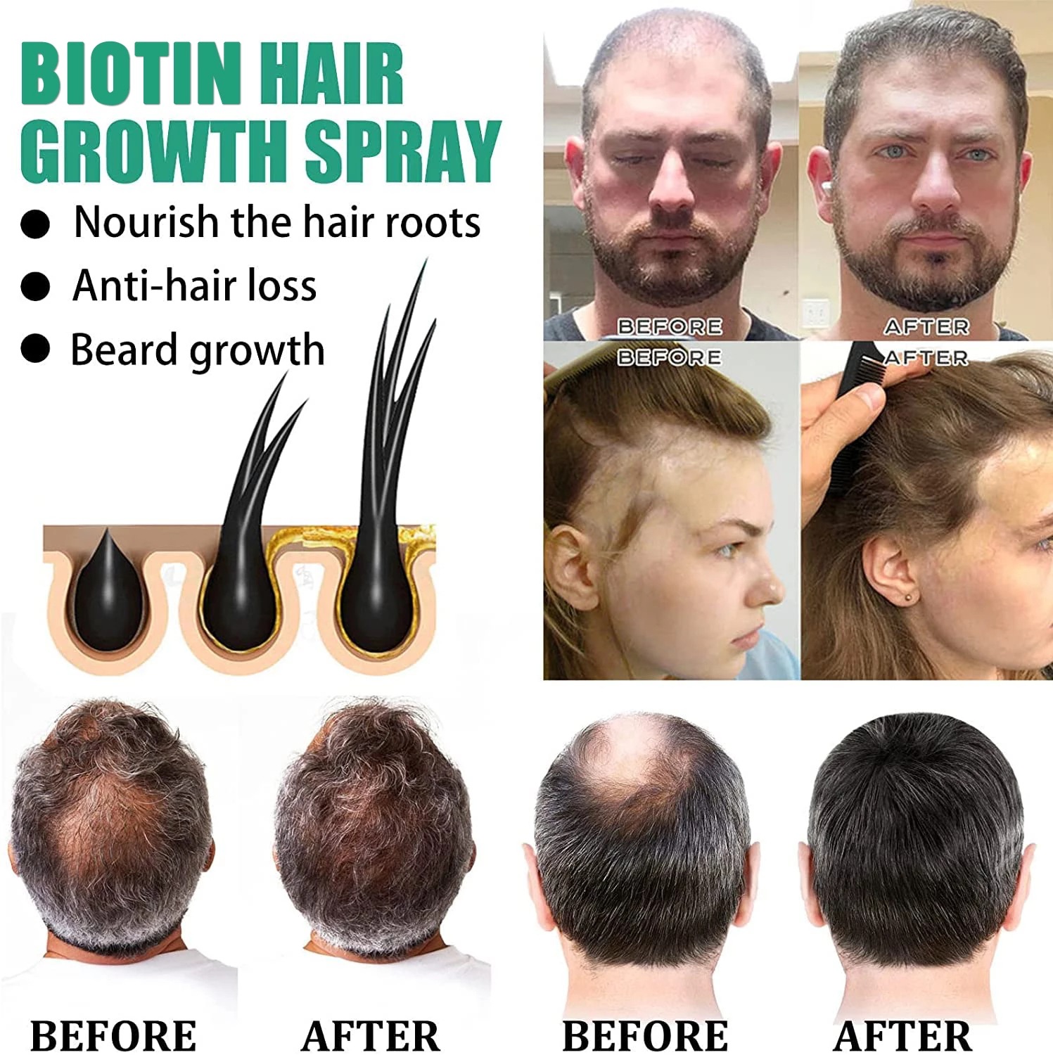 Hair care solution, strong hai – Roots Nutrition & Fitness Inglewood Photos Bewertung und Preis