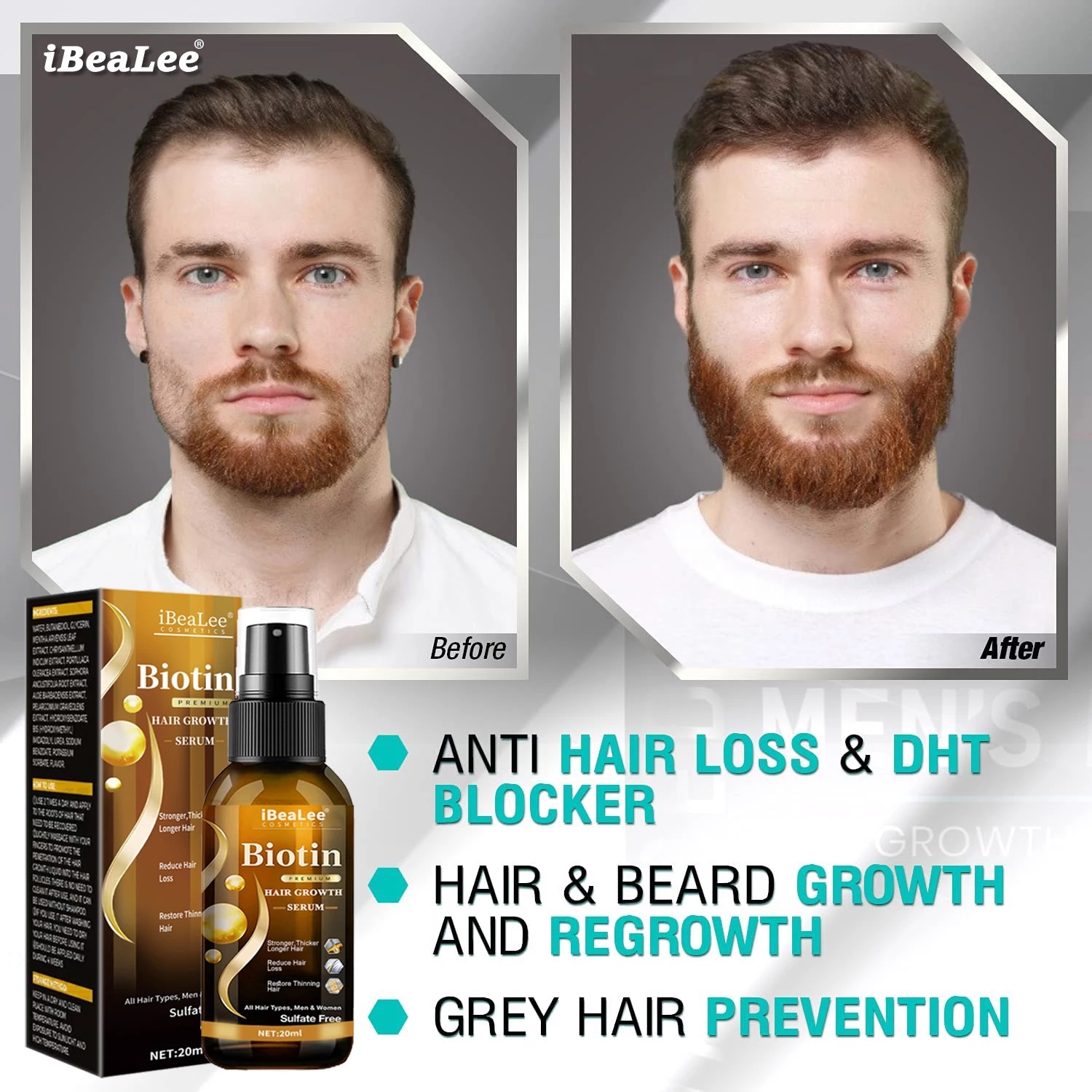 Hair care solution, strong hai – Roots Nutrition & Fitness Inglewood Photos Bewertung und Preis