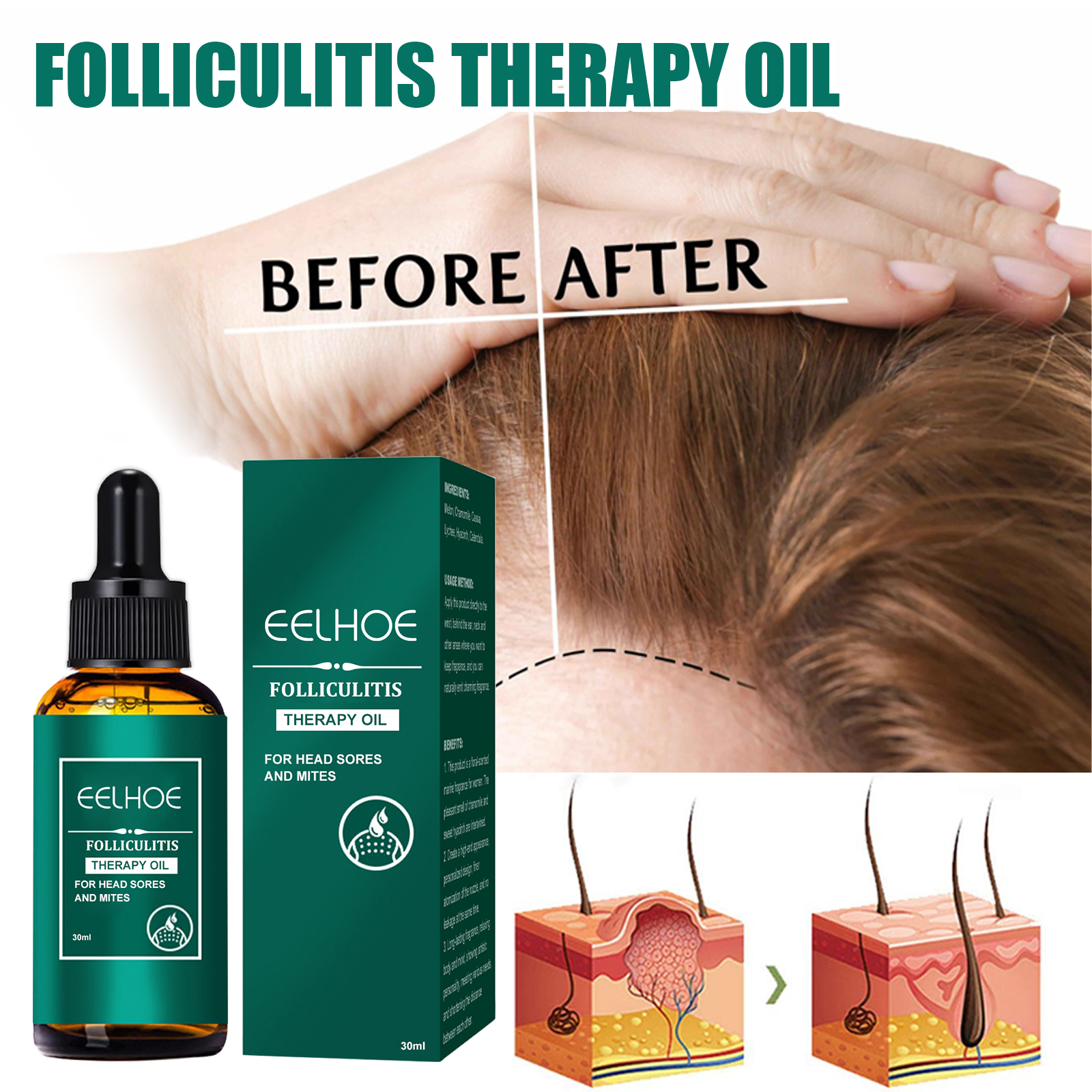 Scalp Treatment Serum Follicle – Roots Nutrition & Fitness Inglewood Photos Bewertung und Preis