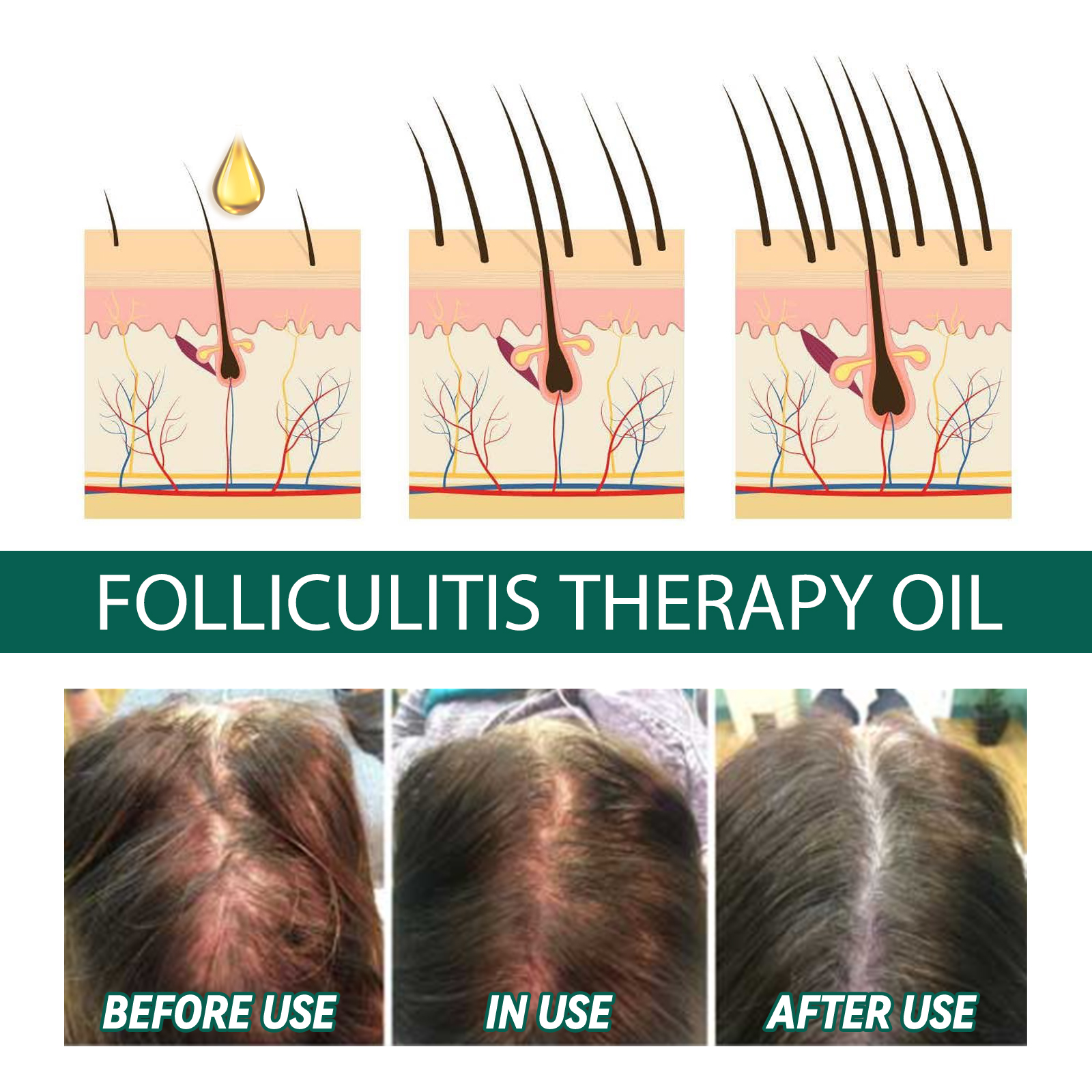 Scalp Treatment Serum Follicle – Roots Nutrition & Fitness Inglewood Photos Bewertung und Preis